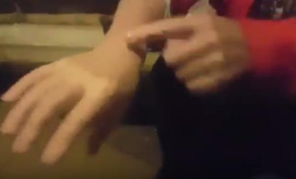 STOPOSTOTNO POBOLJŠANJE NAKON JEDNE POSJETE TUNELIMA