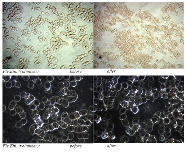 Live Blood Test at RAVNE tunnels, Visoko (Sarajevo)