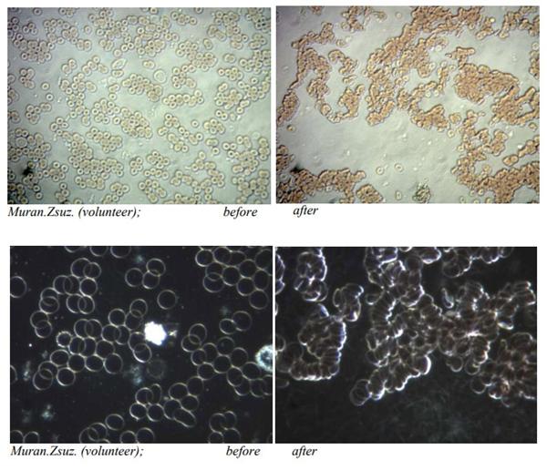 TEST KRVI NA TUNELIMA RAVNE – PRELIMINARNA STUDIJA