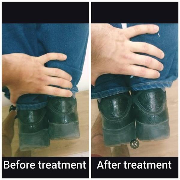 TESTIMONIAL FROM THE CENTER FOR THERAPEUTIC MASSAGE: ‘SHORTER LEG’ RETURNED TO NORMAL STATE