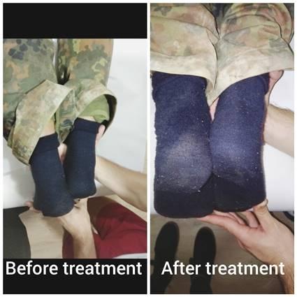 SVJEDOČANSTVA IZ CENTRA ZA TERAPEUTSKU MASAŽU: ‘NAKON JEDNOG TRETMANA VRATILI SMO MARKA U SKORO IDEALNO STANJE’