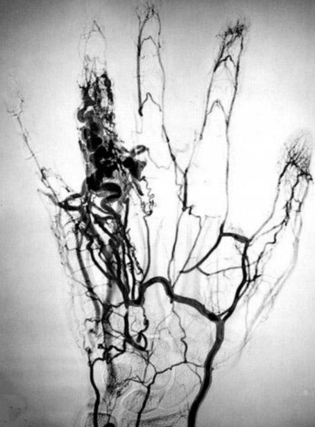 MAGIJSKI RITUALI U NARODNIM PREDAJAMA O STEĆCIMA