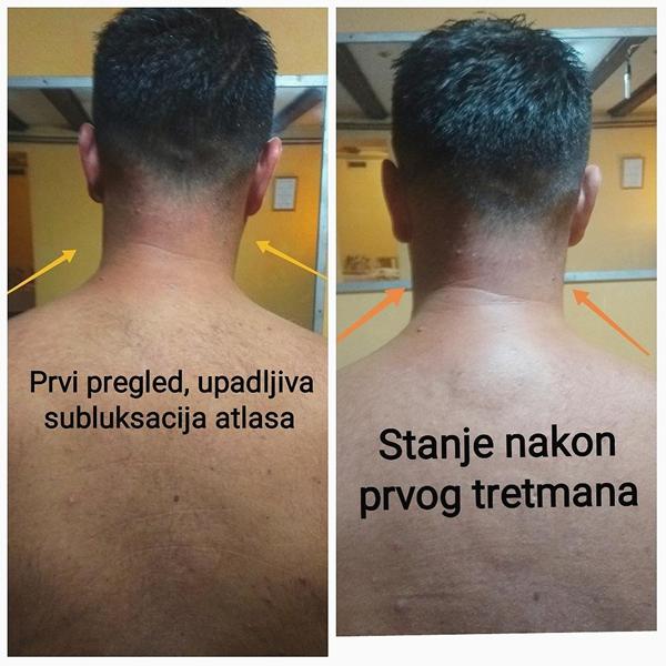 EDUKACIJA MIŠE VULETIĆA IZ CENTRA ZA MASAŽU I KIROPRAKTIKU