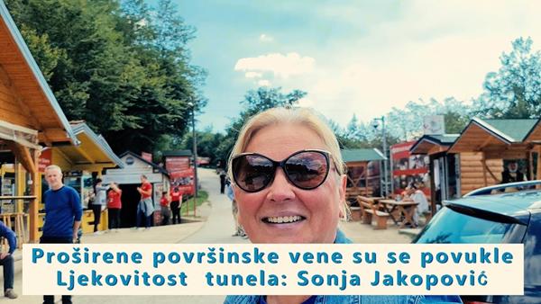Proširene površinske vene su se povukle